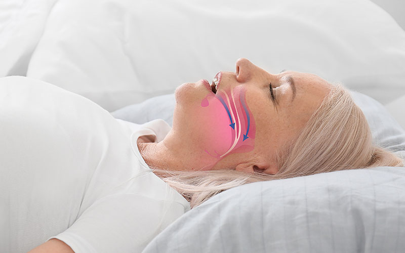 Things You Should Know About Sleep Apnea Treatment in Edmonton